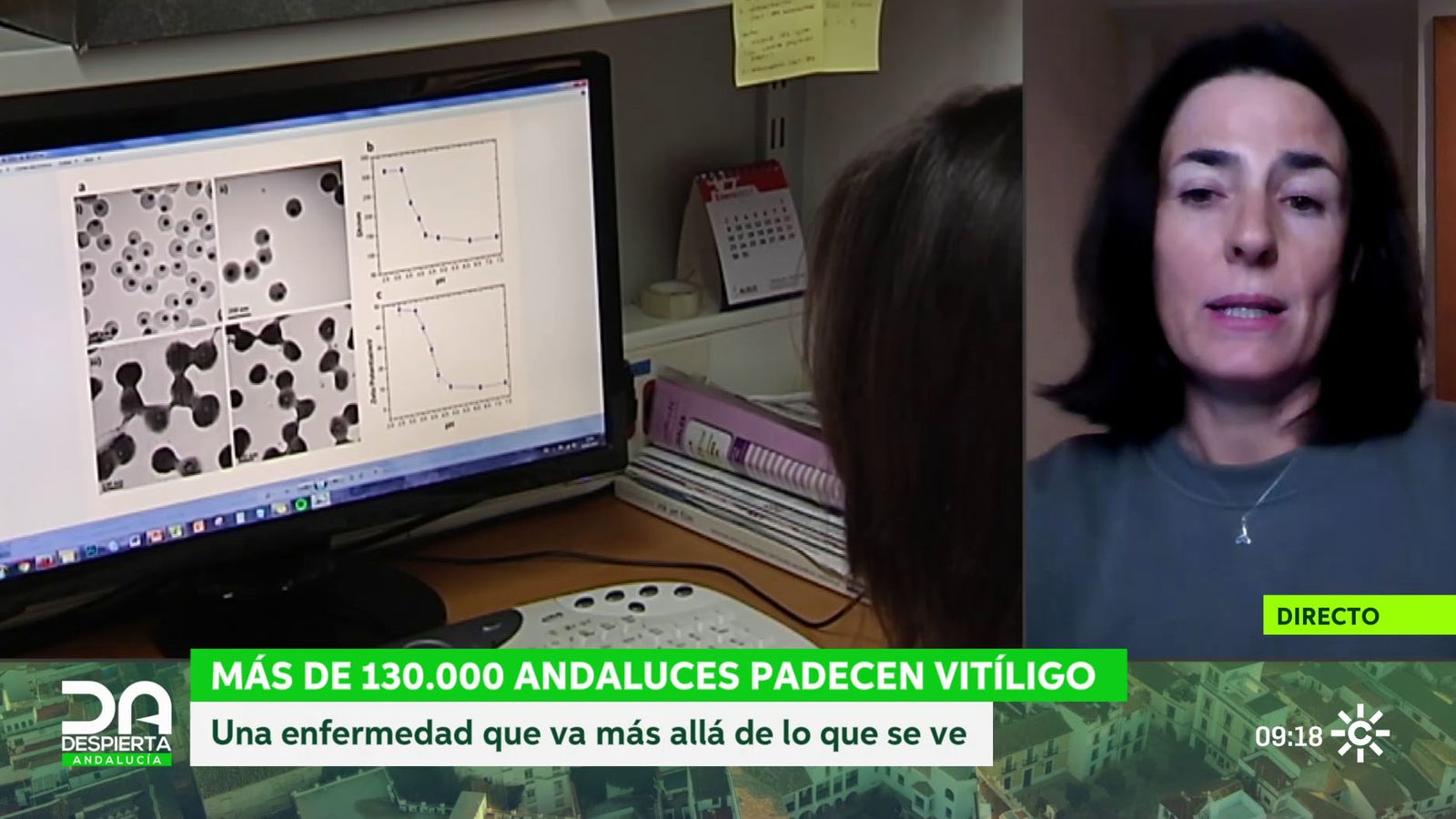 Gloria Llanos, asociación pacientes vitíligo