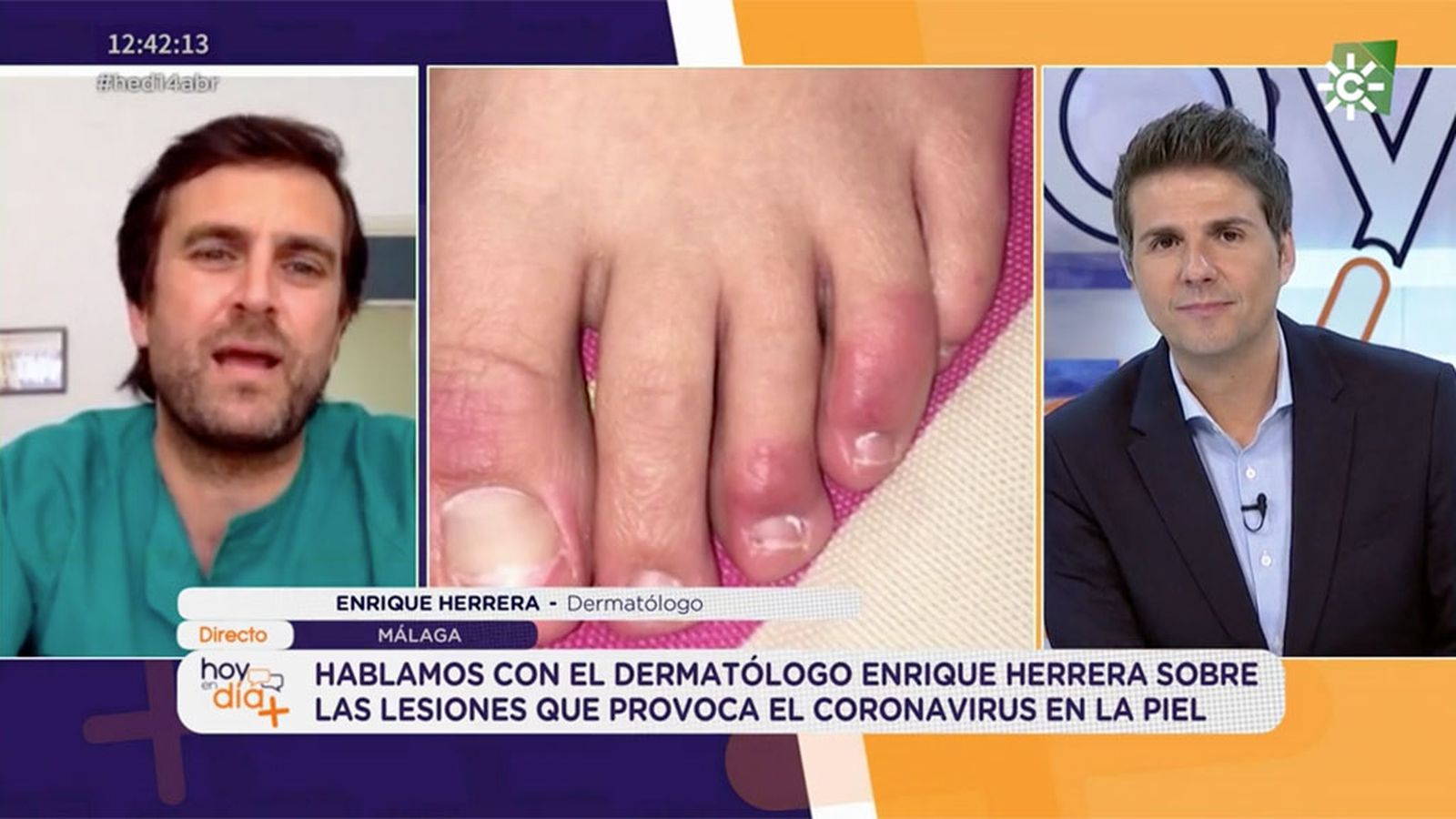 Hoy en día Lesiones en la piel  3