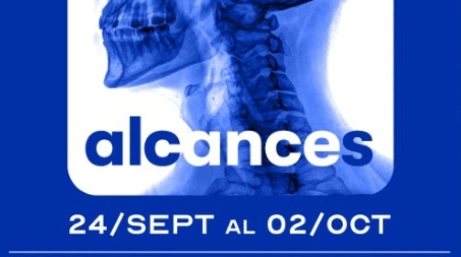 ALCANCES