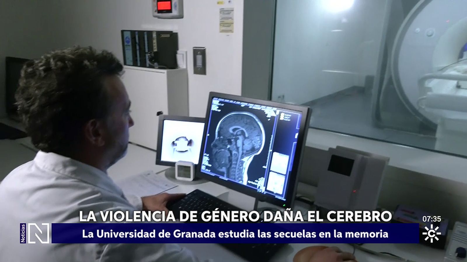 La Universidad de Granada investiga las secuelas de la violencia machista en el cerebro