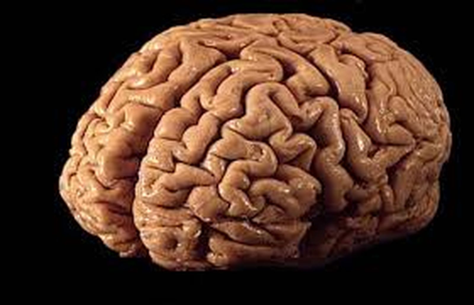 cerebro