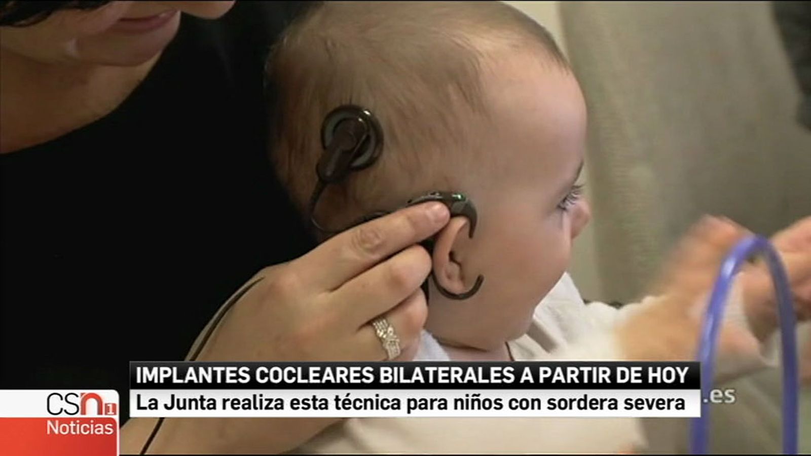 N1-Coclear