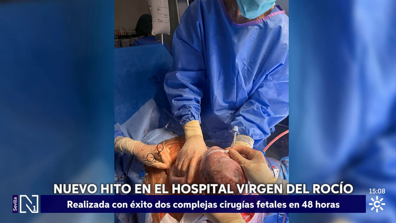 El Virgen del Rocío practica con éxito dos operaciones fetales en solo 48 horas