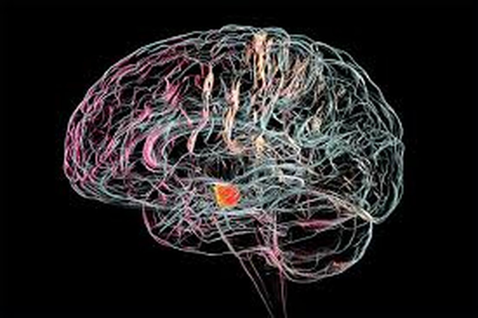 parkinson