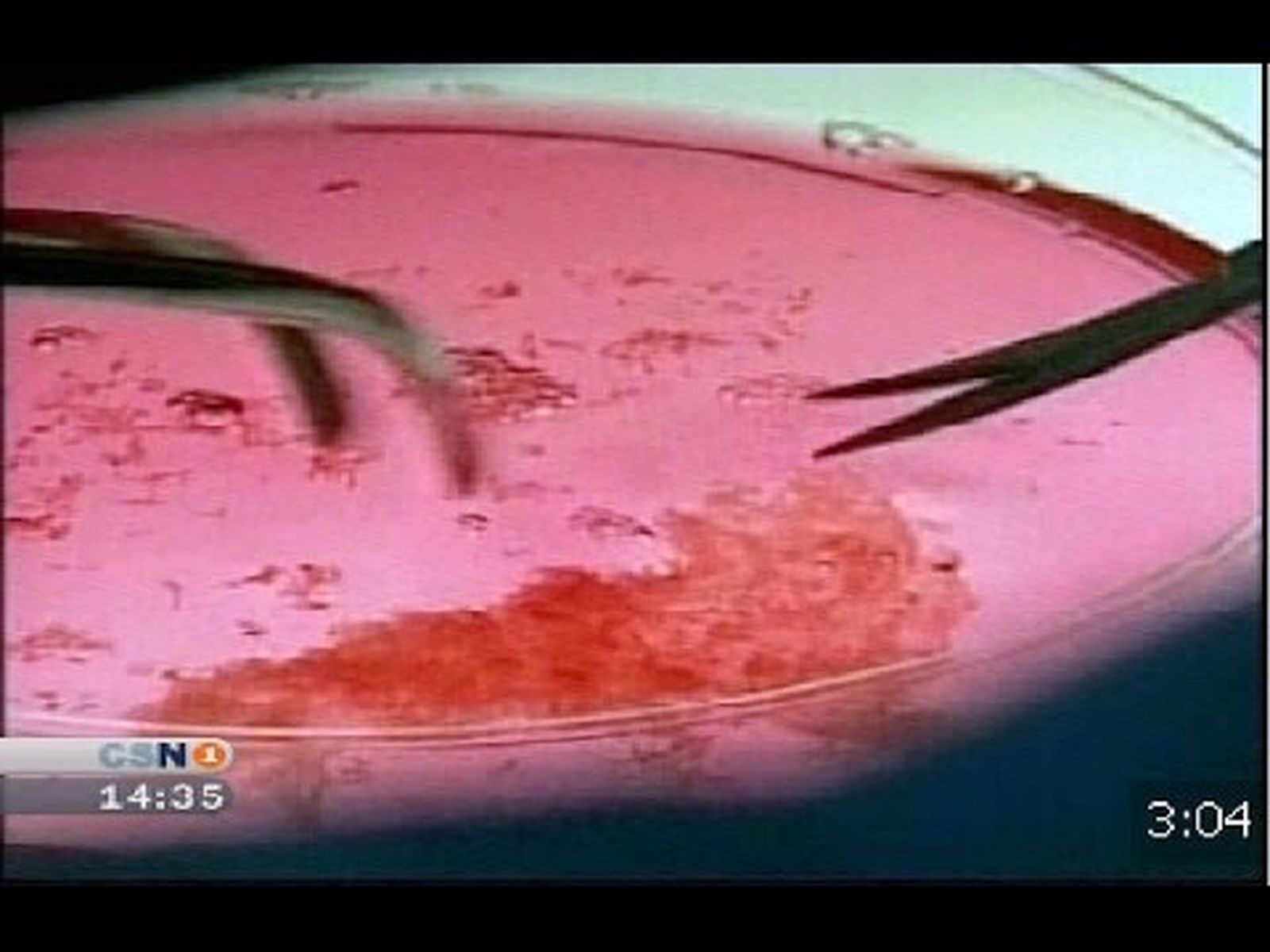 Proyecto Genoma Médico: investigación pionera en el mundo