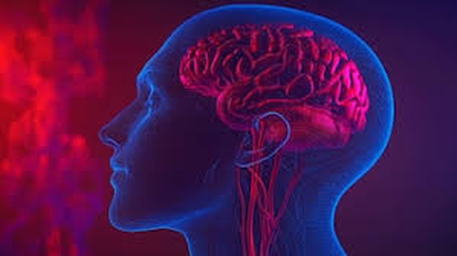 CEREBRO