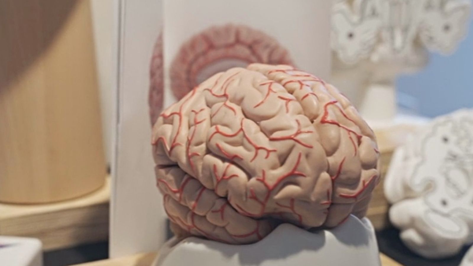 Tesis cerebro