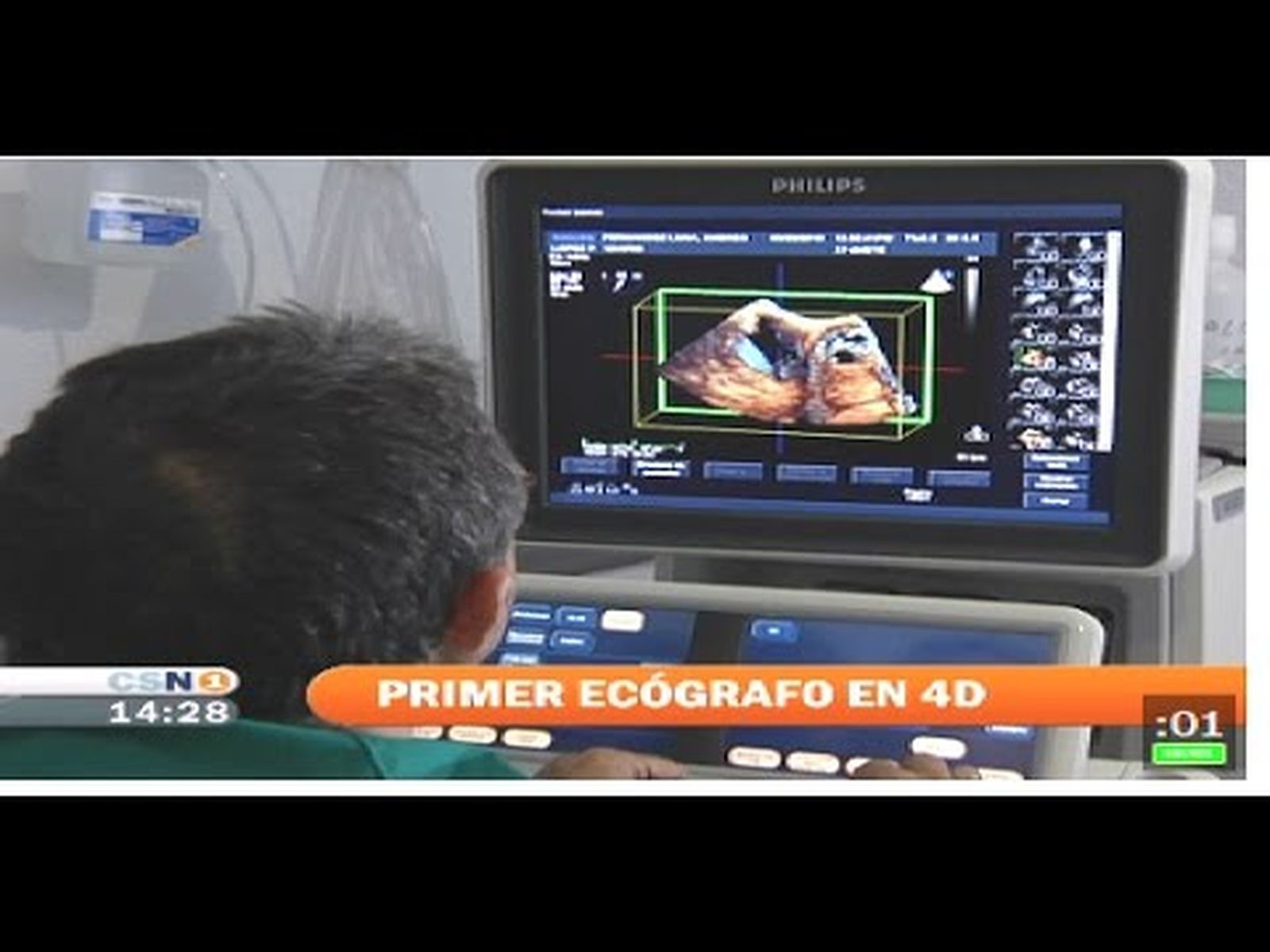 Hospital Virgen del Rocío de Sevilla: primer ecógrafo 4D de España