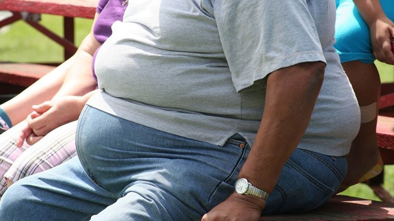 obesidad