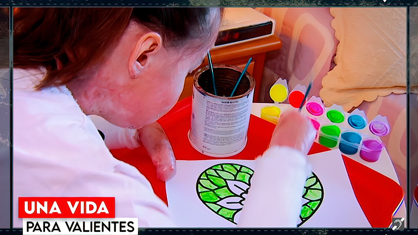 "Los Reporteros" y la piel de mariposa.