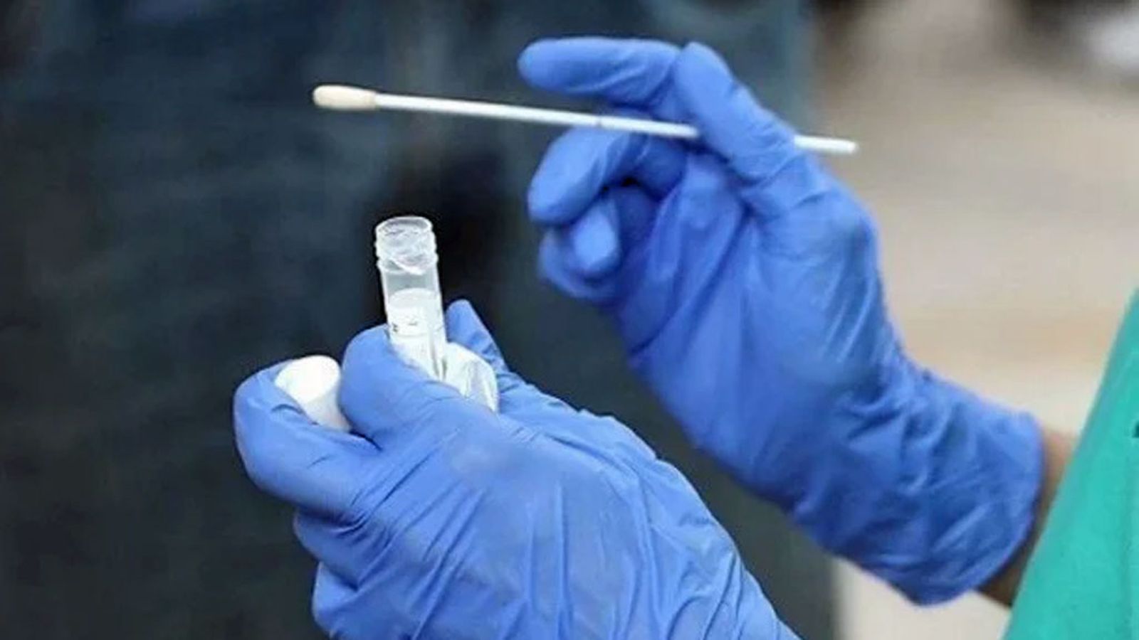 test coronavirus