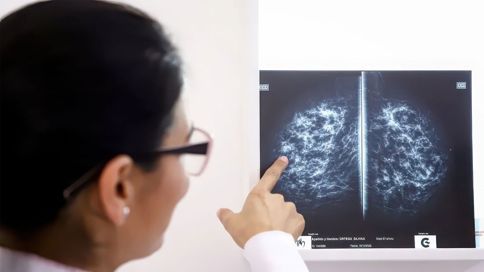 La investigación y la detección precoz, claves contra el cáncer de mama