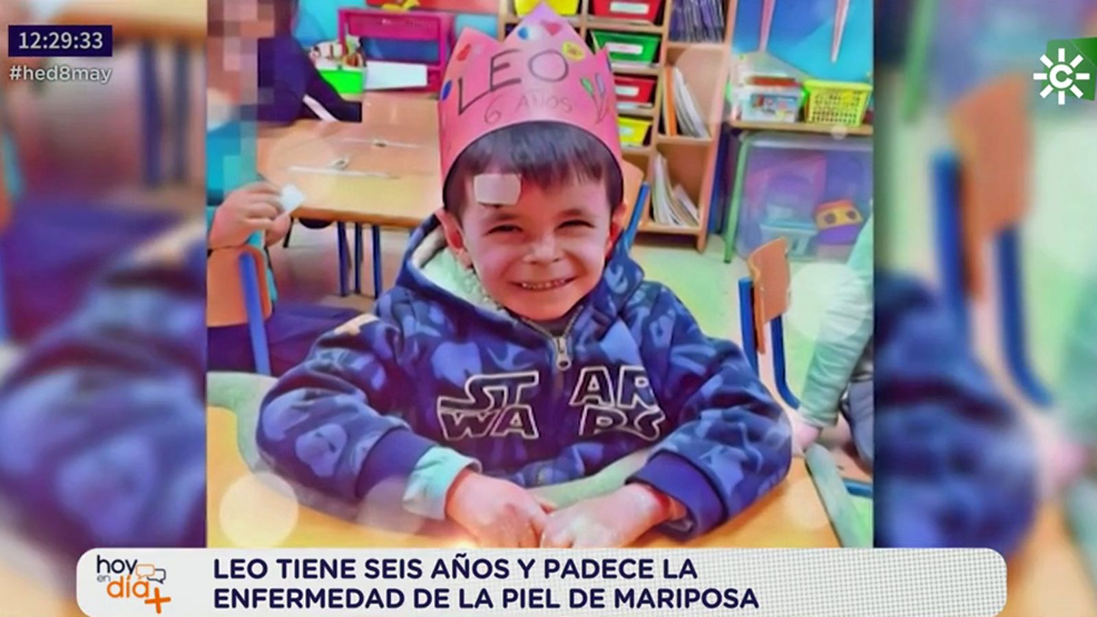 foto leo piel de mariposa