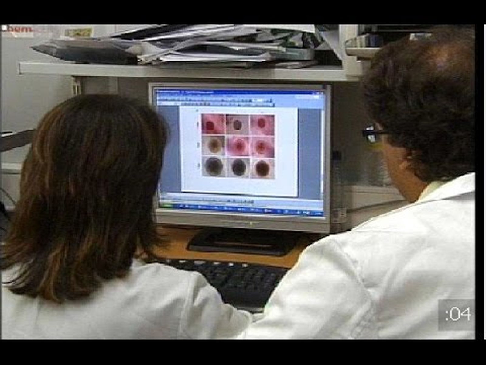 El gen suicida del cáncer investigado por la Universidad de Granada