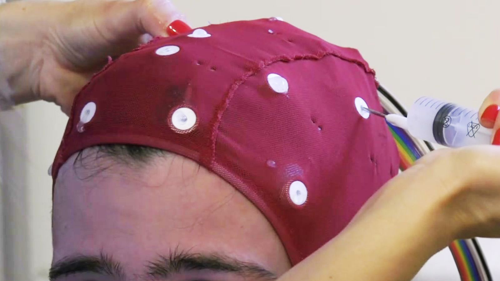 Epilepsia, conocemos los últimos los avances en su diagnóstico y tratamiento