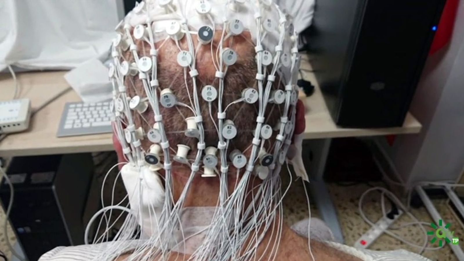 Tratamiento innovador contra el párkinson desarrollado en Cádiz