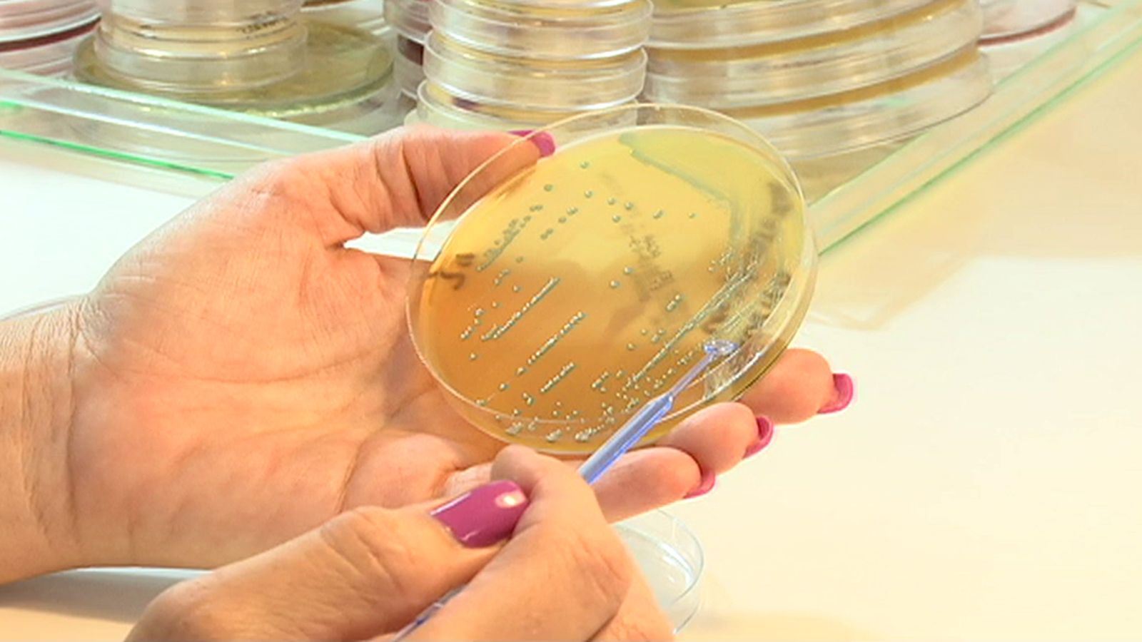 Listeria Análisis Muestra