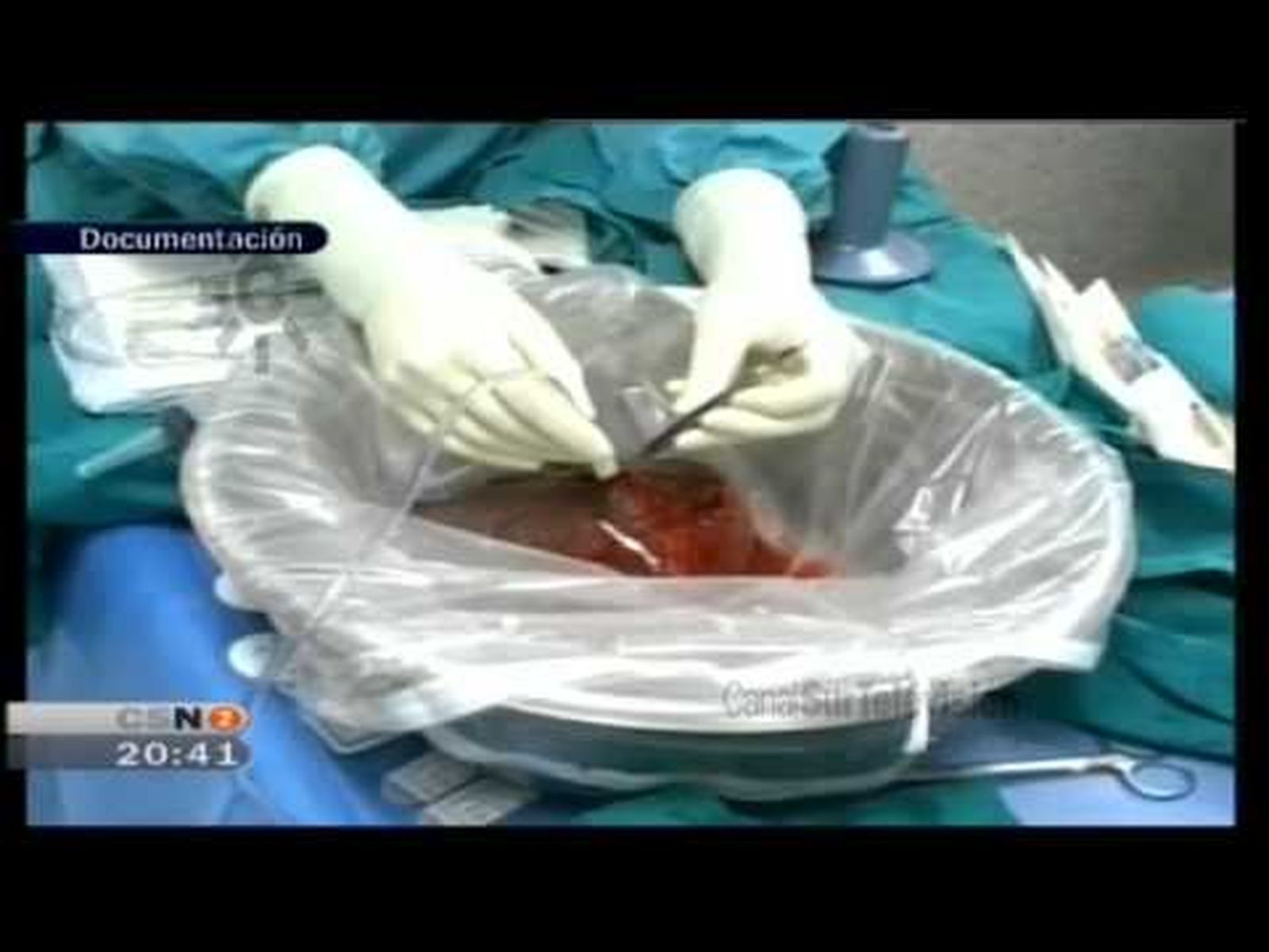 Donaciones multiorgánicas en el hospital Reina Sofía de Córdoba (2008)