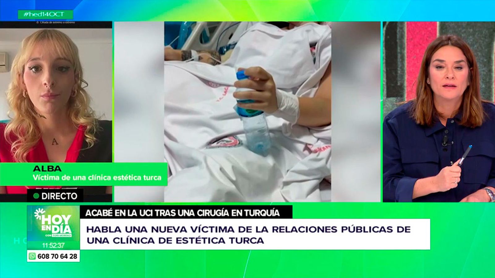 Alba acabó en la UCI tras una cirugía estética 'low cost' en Turquía