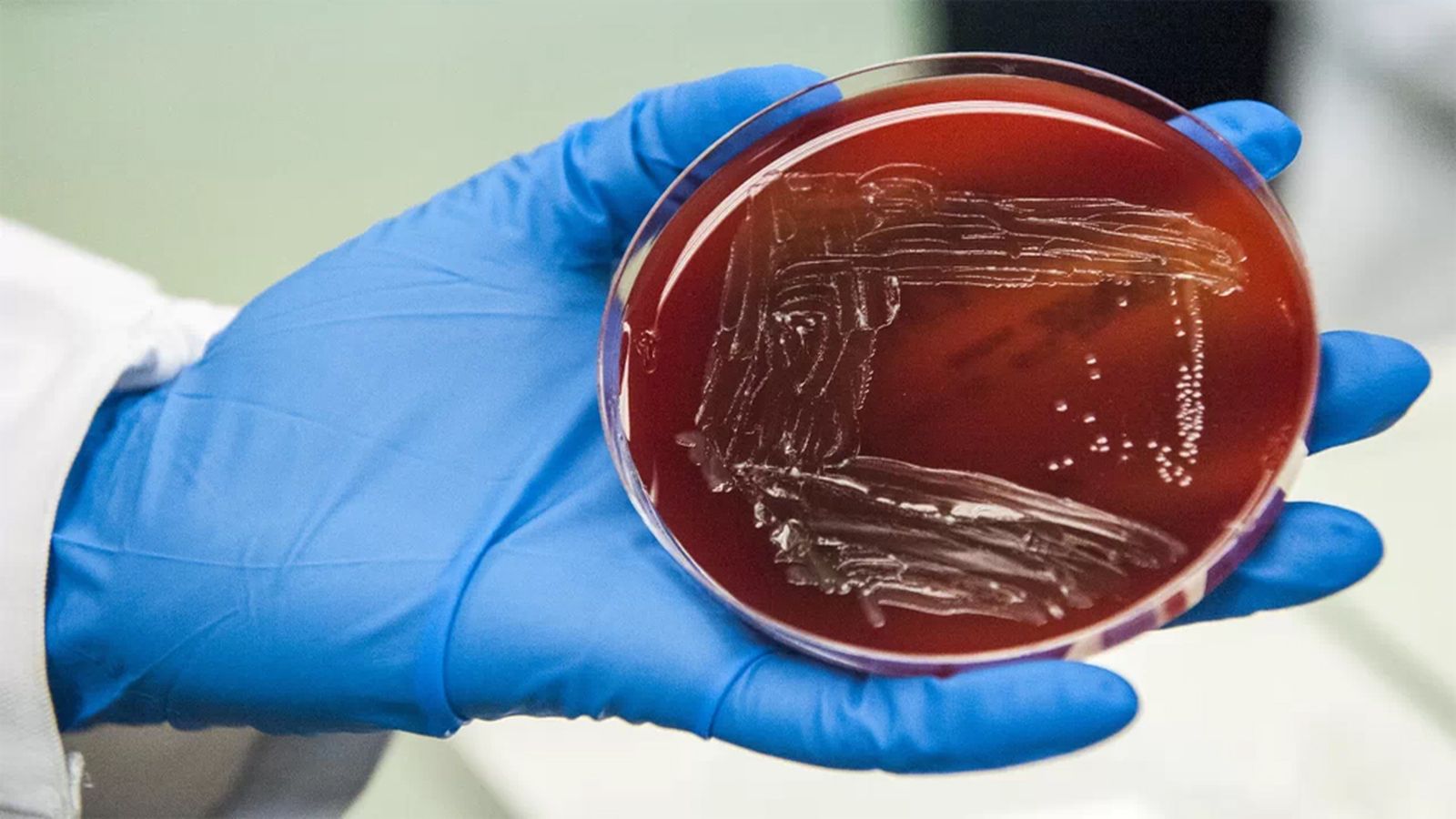Listeria detalle laboratorio