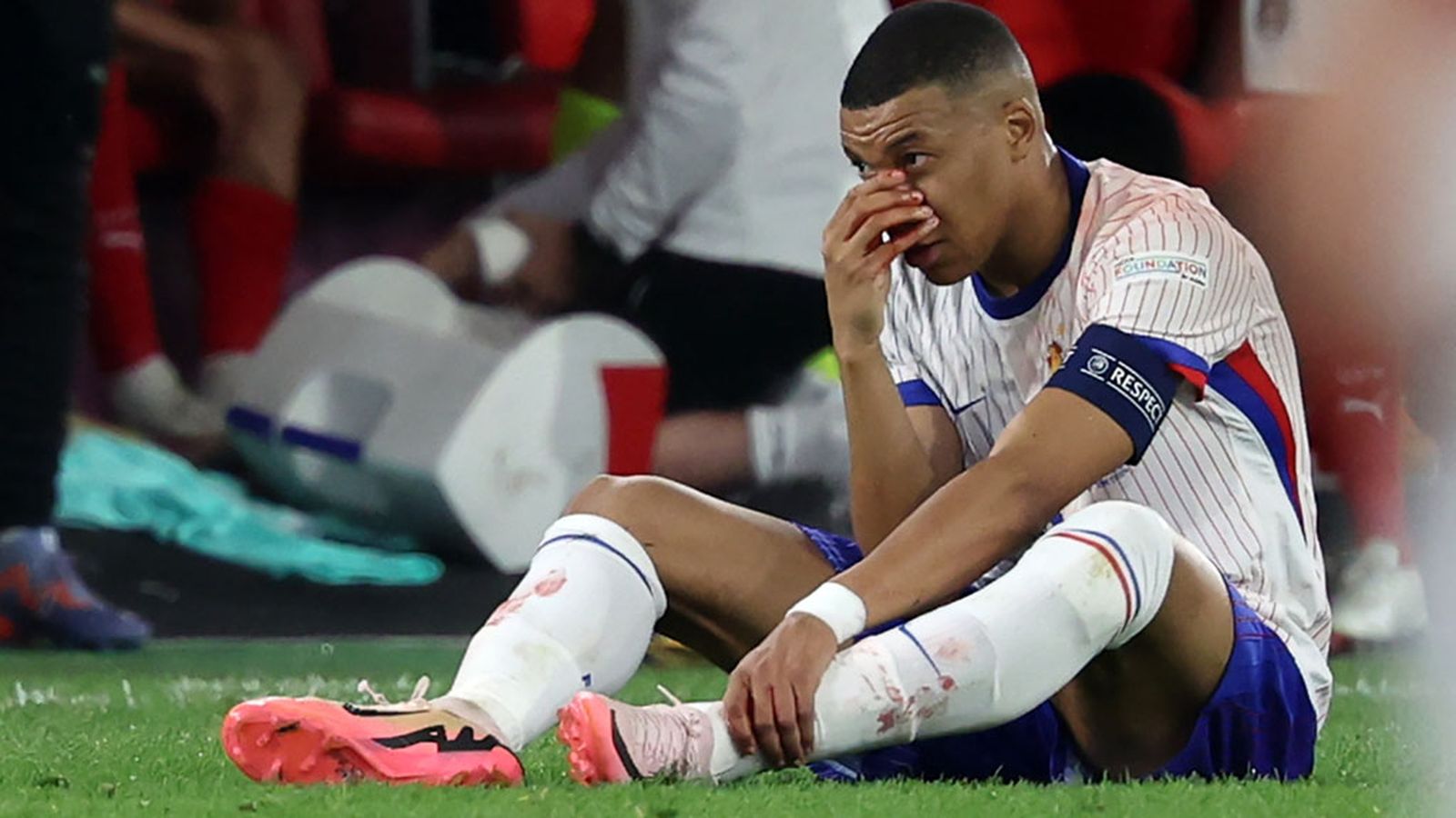 Mbappé se rompe la nariz Eurocopa