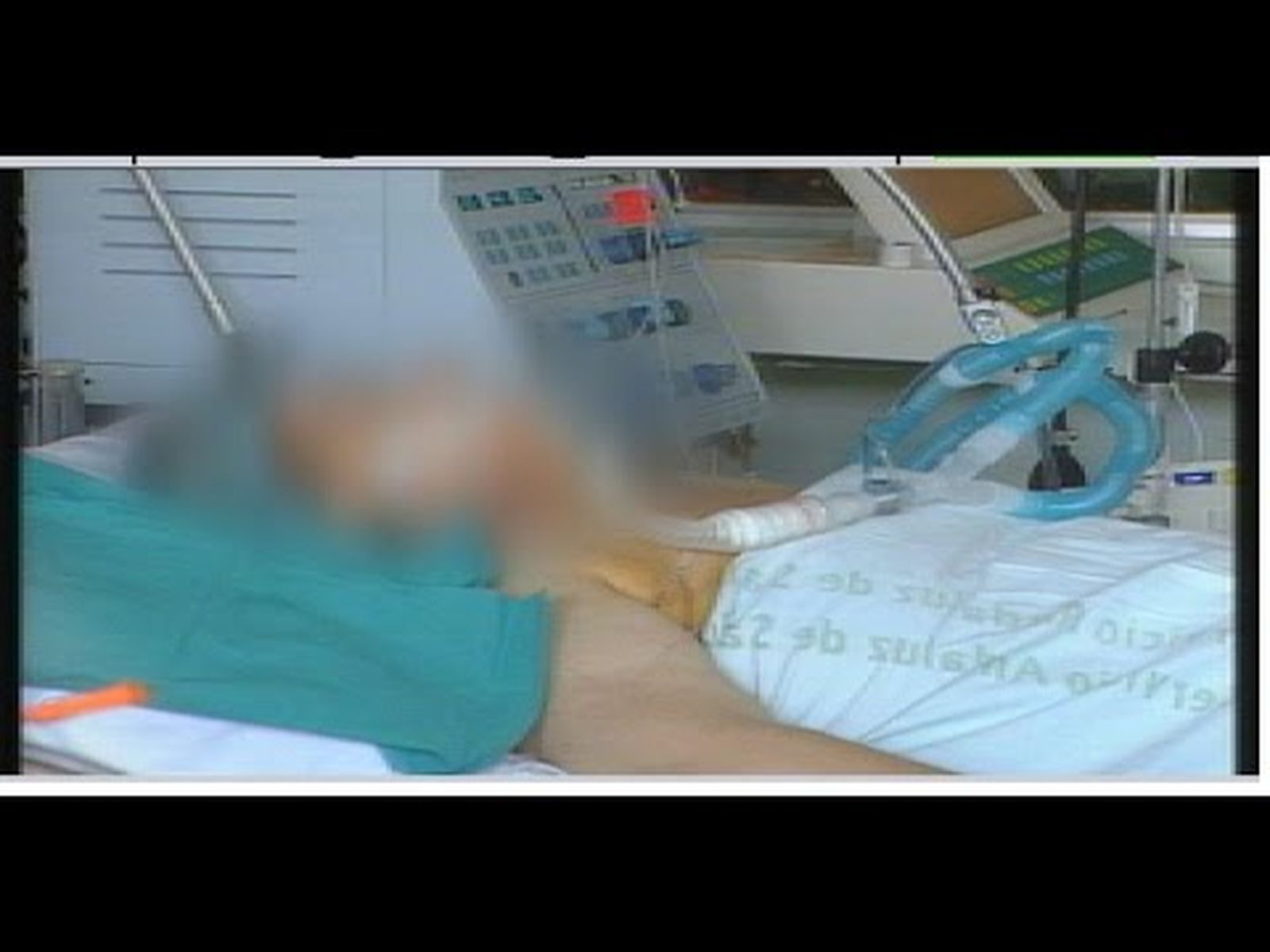Hospital Reina Sofía de Córdoba: primer trasplante doble de pulmón de Andalucía