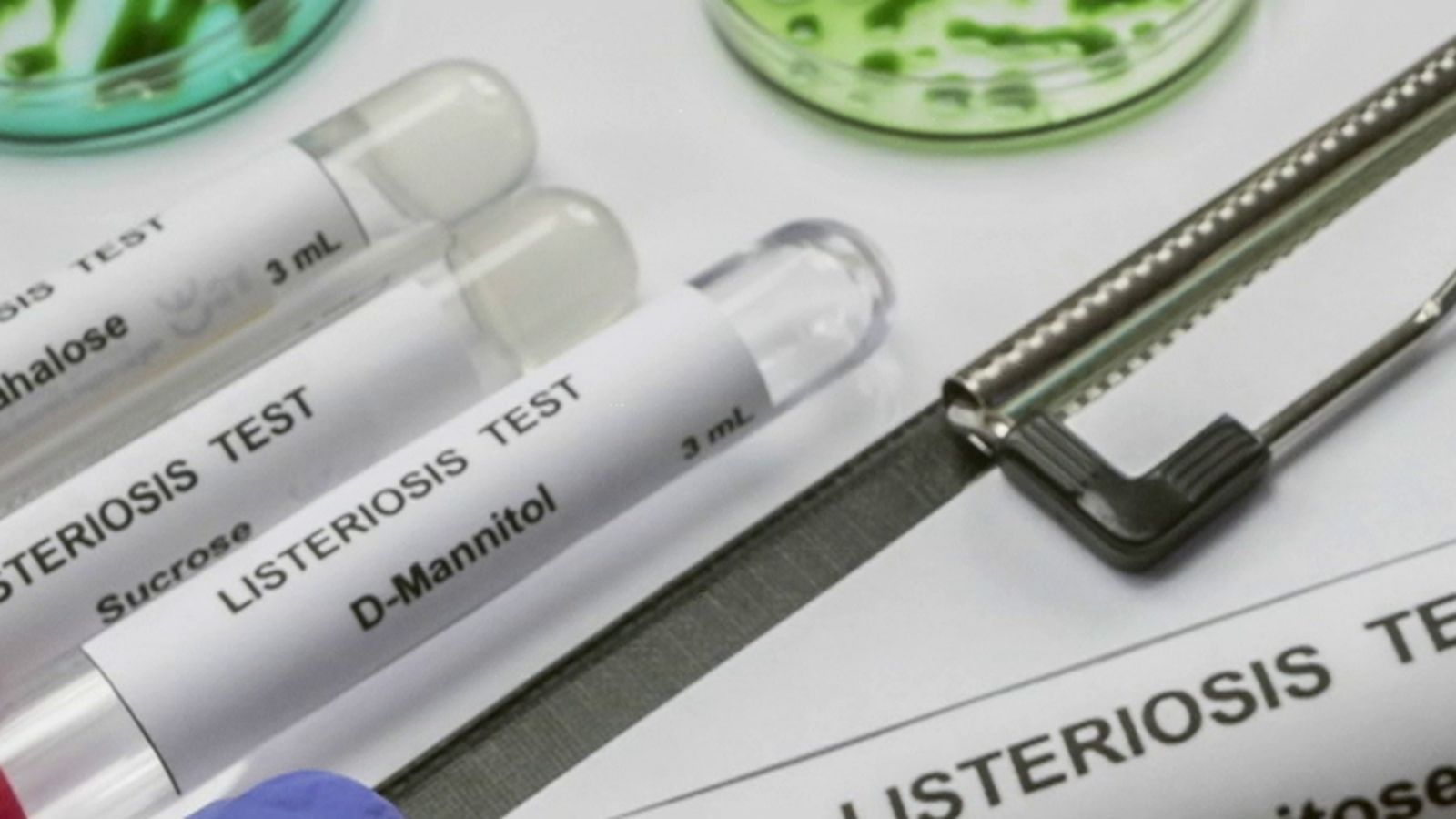 Viales Listeriosis 1024