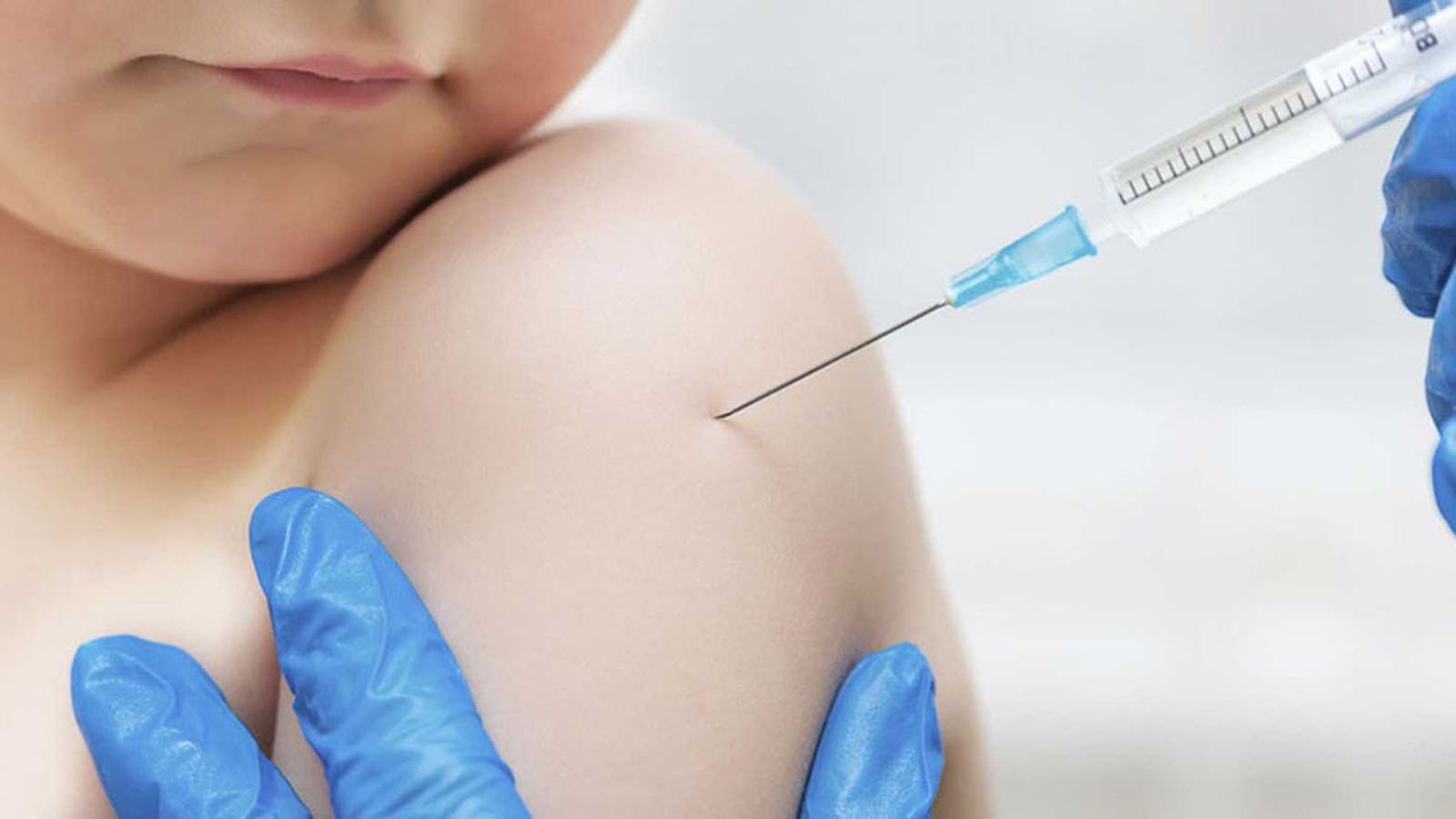 MENINGITIS
