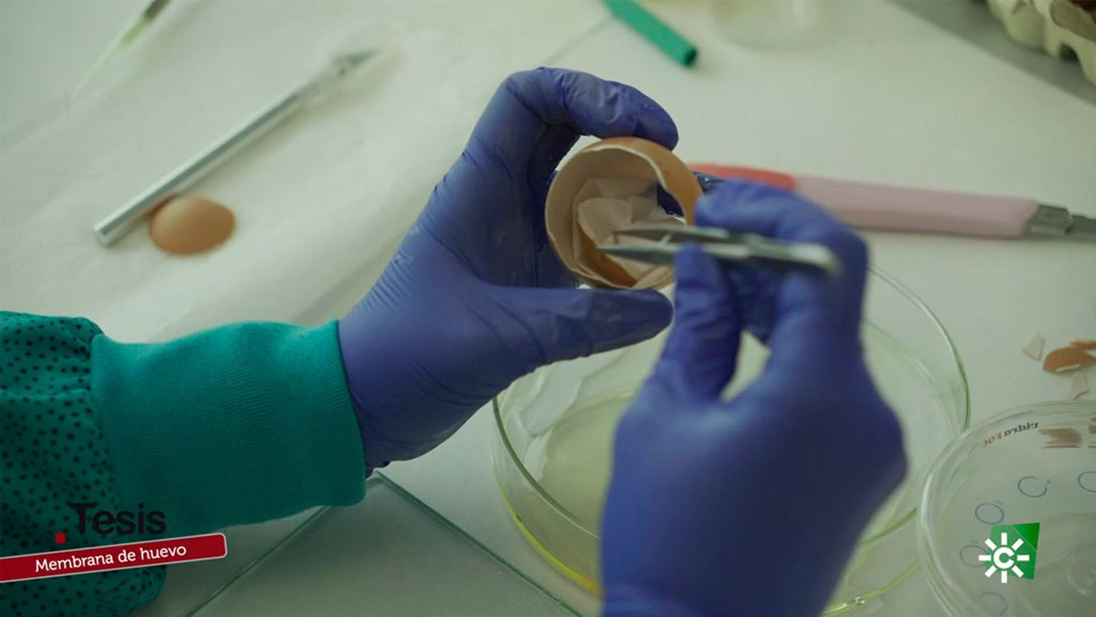 Un biomaterial con propiedades regenerativas