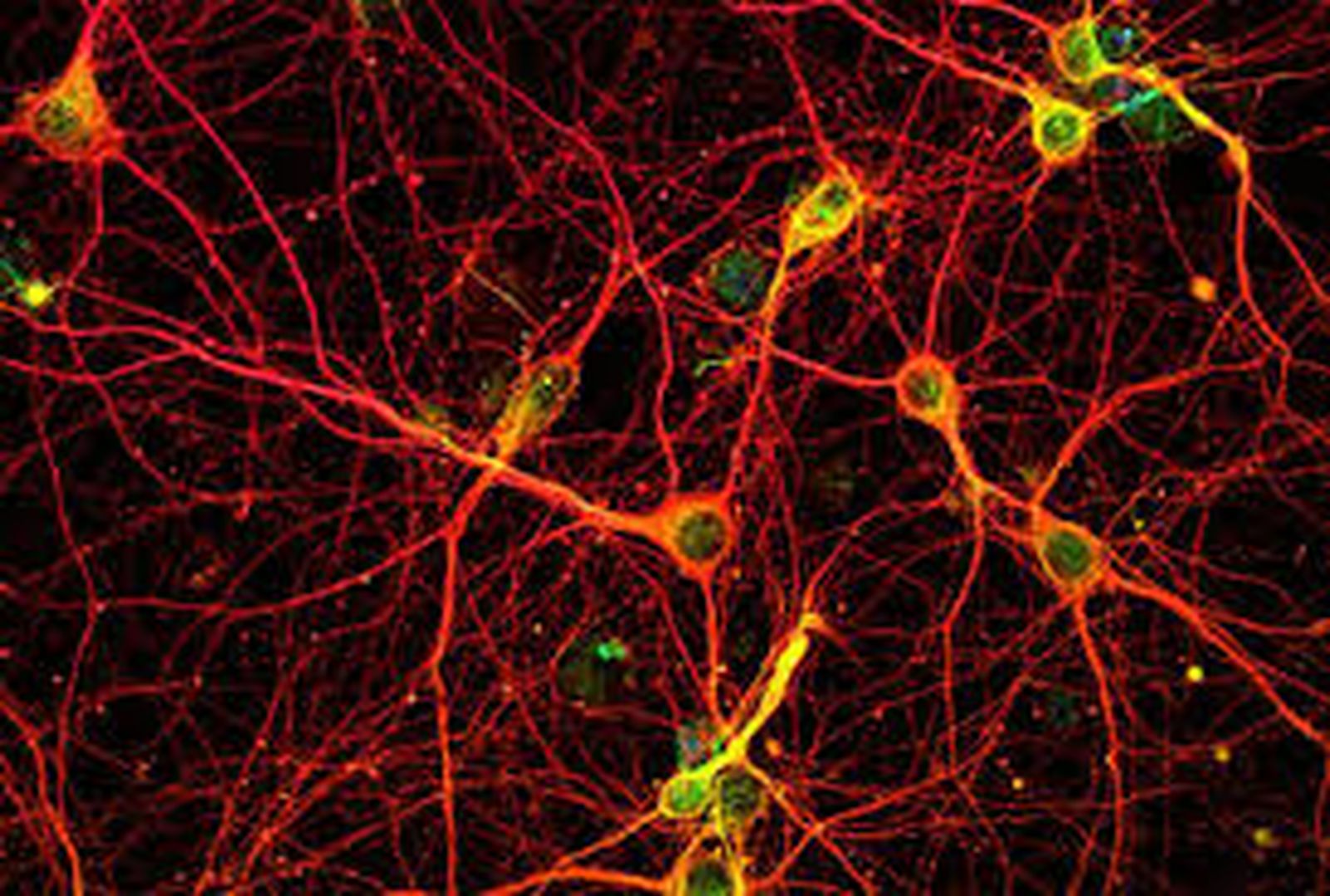 neuronas