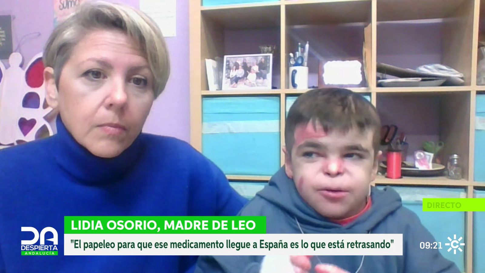 Leo, un niño sevillano con Piel de Mariposa