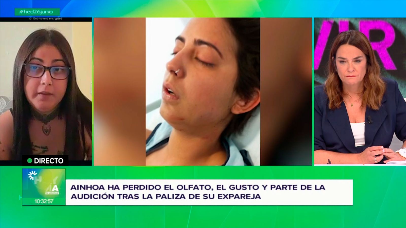 Una víctima de violencia machista pide la eutanasia, “ojalá me hubiera matado” él