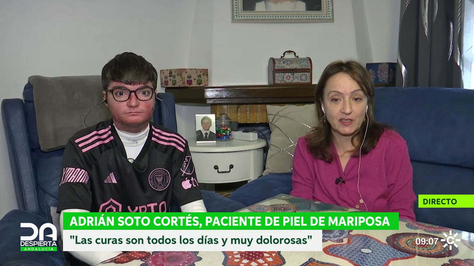 Despierta Adrián Piel de Mariposa