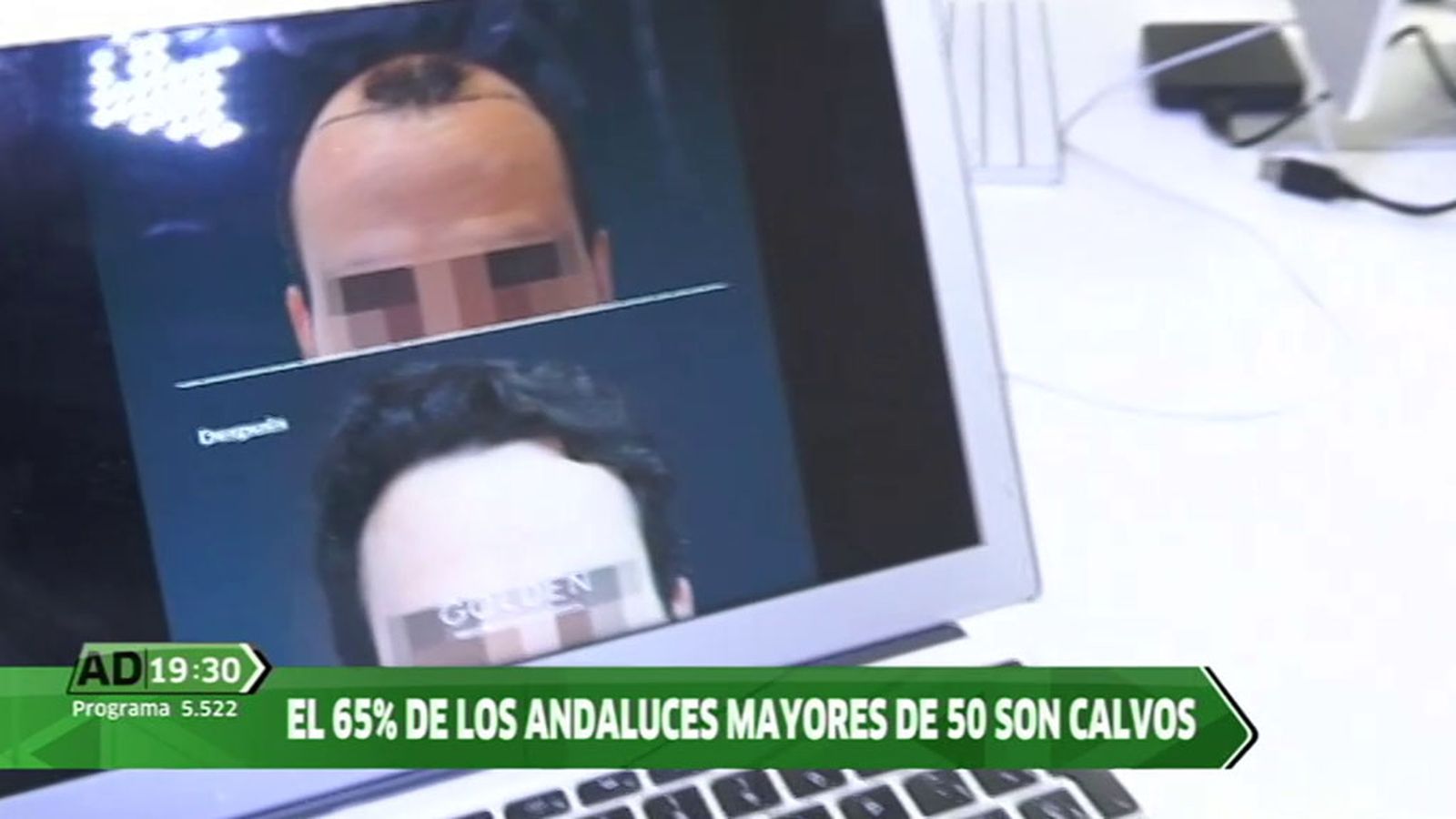 TAPA_CALVO 1