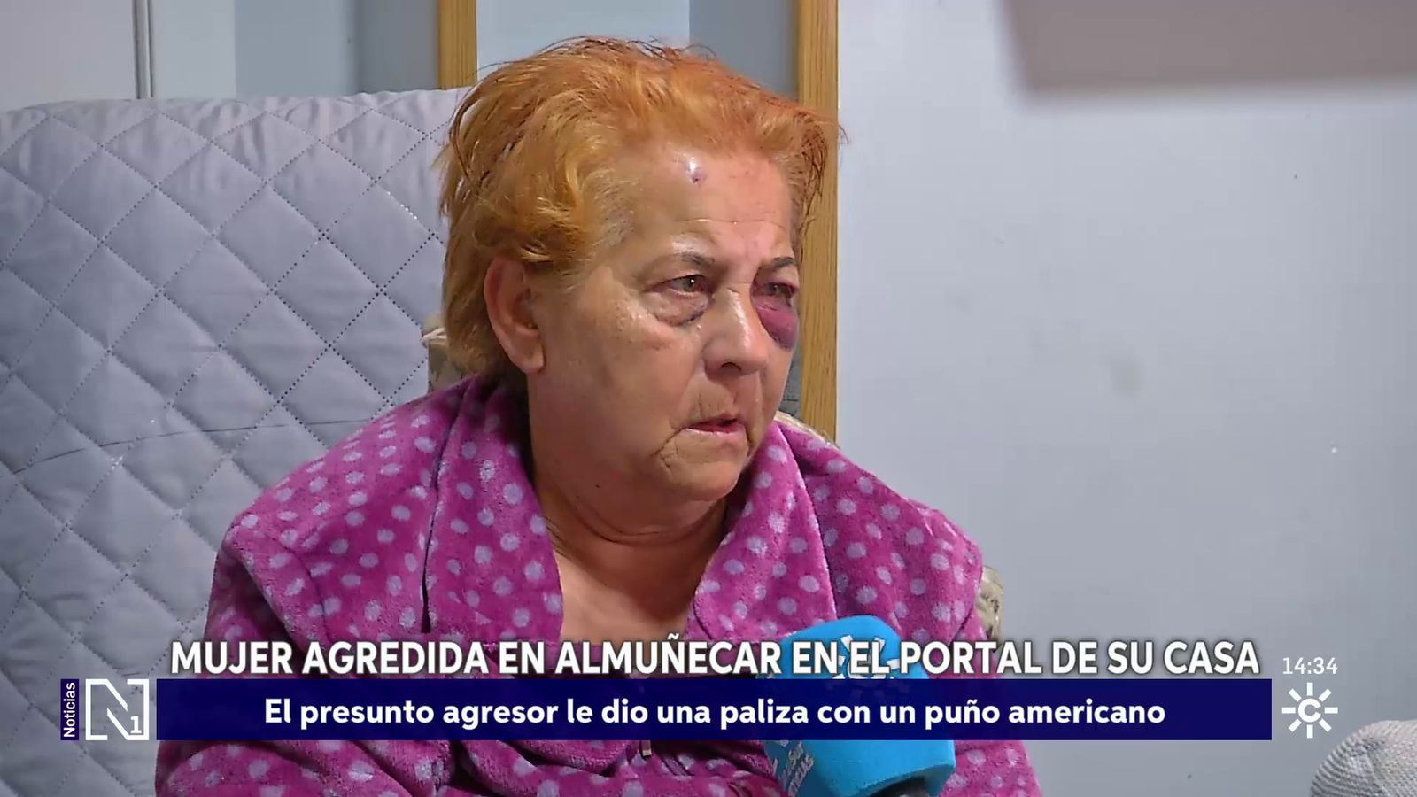 Brutal agresión a una mujer de 69 años en Almuñécar