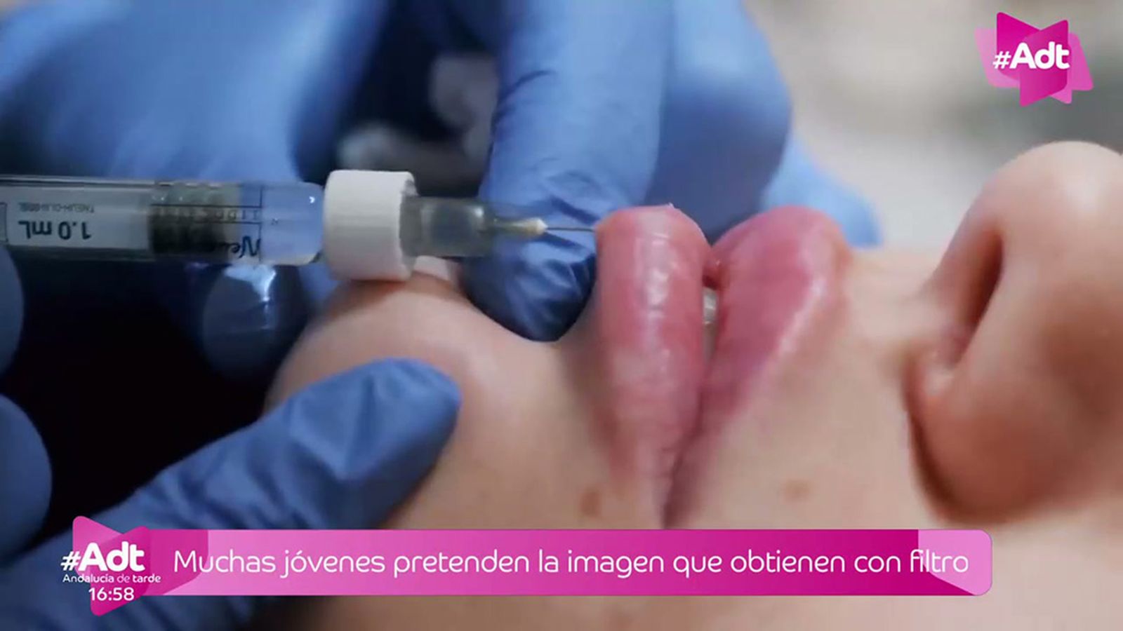 Los Reyes Magos recibieron un aluvión de cartas de las jóvenes pidiendo cirugía estética