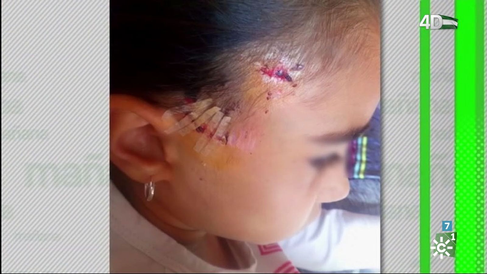 Niña atropellada en Córdoba